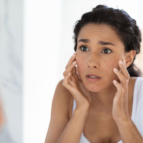 Why Your Skin Suddenly Reacts to Products You've Used for Years
